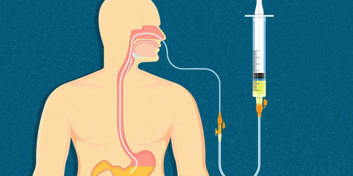 Enteral Feeding Tube Market Solutions and Services to 2031